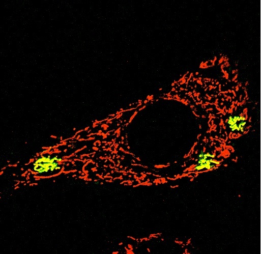 Photomicrography of a dermal mesenchymal stem cell depicting the mitochondrial network (in red, stained by TMRE) and a few individually photoactivated mitochondria (in green, stained by mito-PAGFP). Magnification 63x.